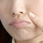 ほうれい線 気になる。